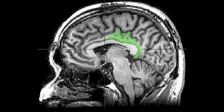 Descubren en el cerebro por qué nos afectan tanto los recuerdos más traumáticos