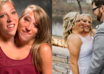 Una de las siamesas Hensel se casó y genera controversia en las redes sociales: ¿Cómo es su vida íntima?