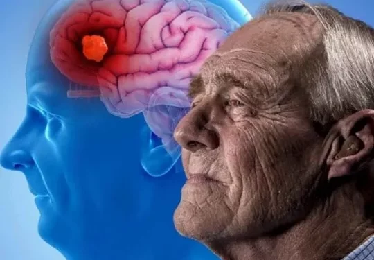 Cuál es el alimento que Harvard recomienda para prevenir el Alzheimer