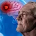 Cuál es el alimento que Harvard recomienda para prevenir el Alzheimer